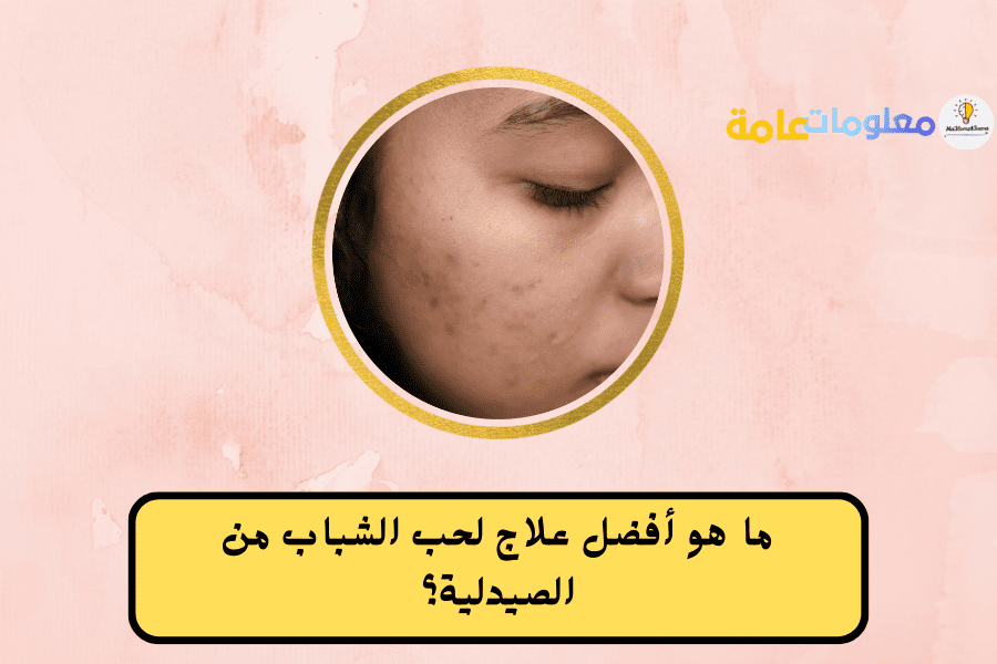 ما هو أفضل علاج لحب الشباب من الصيدلية؟ 3 أنواع تعرف عليها