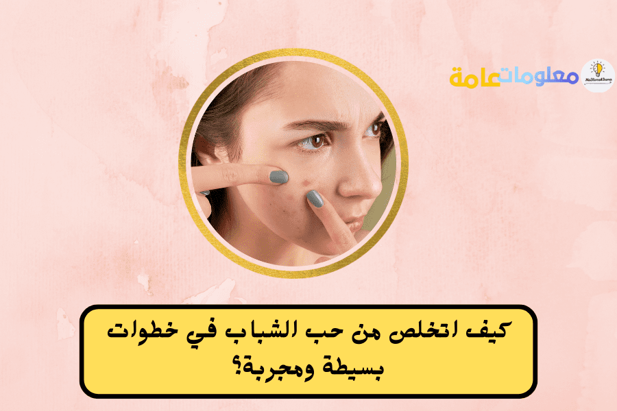 كيف اتخلص من حب الشباب لكثرة الحبوب في الوجه؟