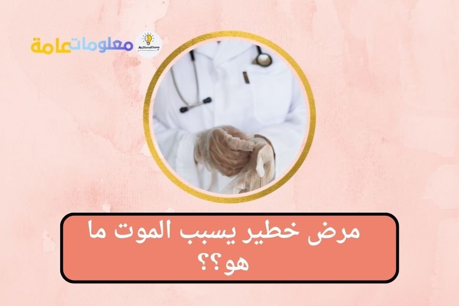 ماهو مرض الكوليرا؟ وهل يسبب الموت؟ وما هي اعراضه