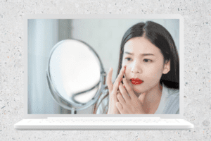 الأسباب العلمية والطبية لظهور الهالات السوداء