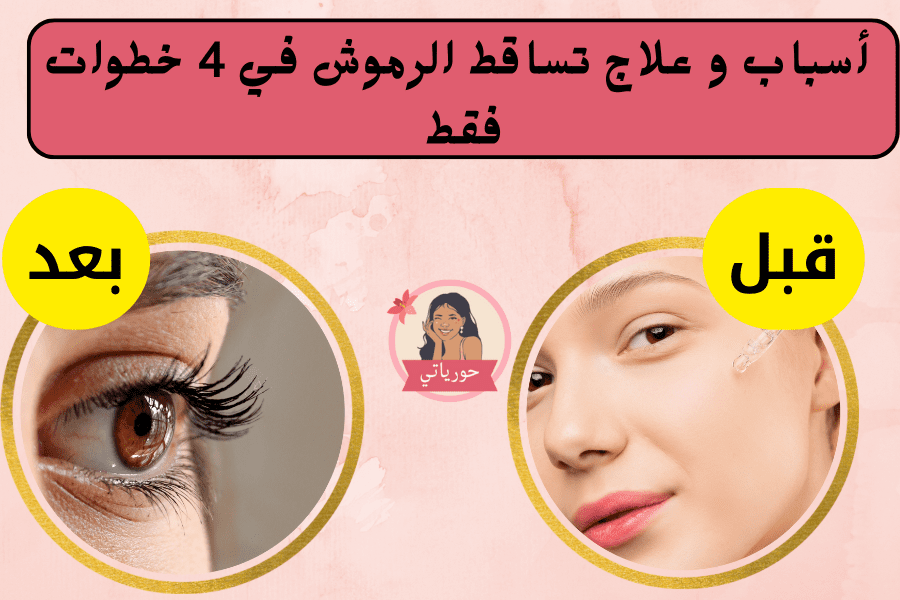 أسباب و علاج تساقط الرموش في 4 خطوات فقط