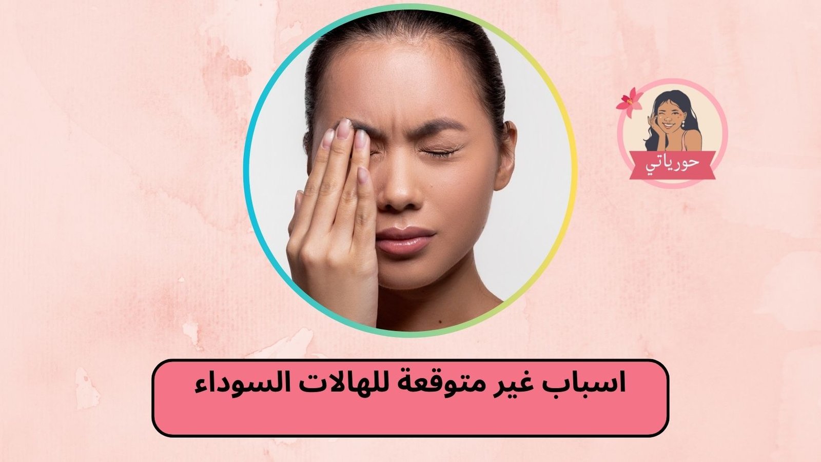 اسباب غير متوقعة للهالات السوداء