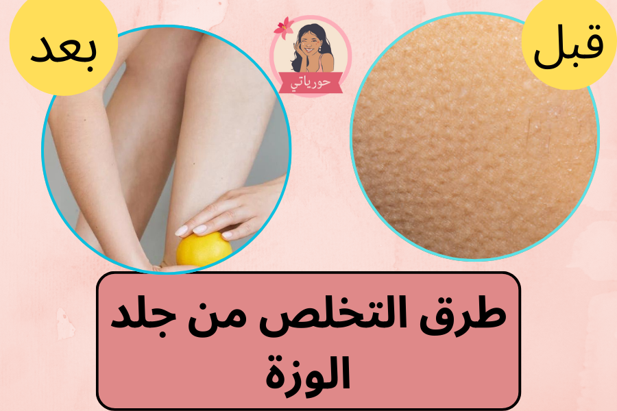 طرق التخلص من جلد الوزة