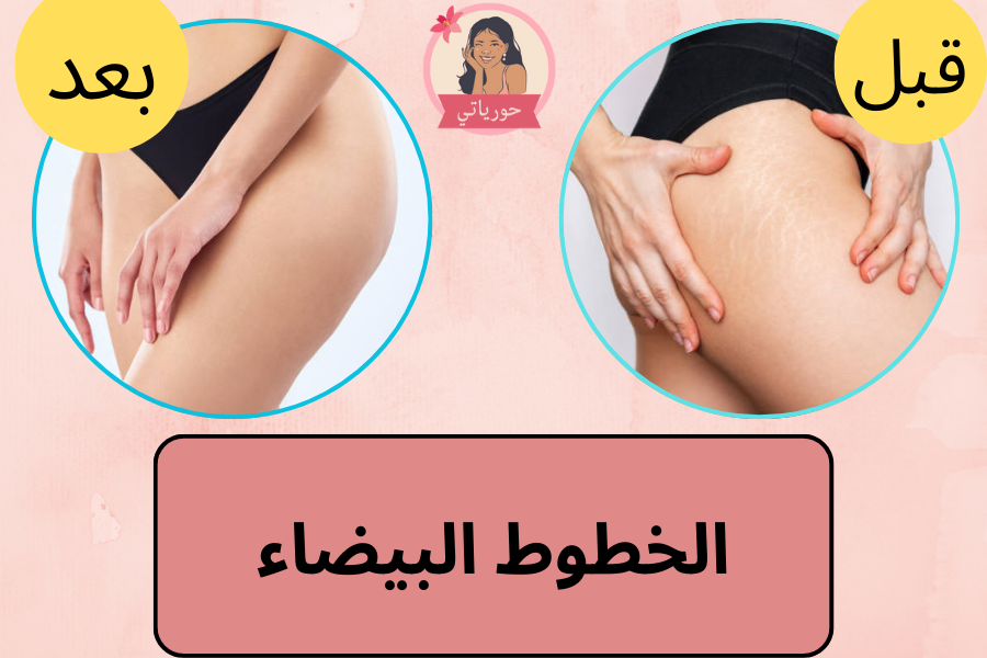 الخطوط البيضاء