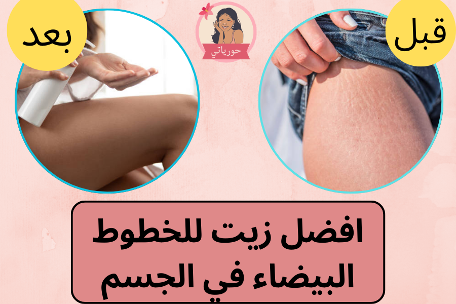 افضل زيت للخطوط البيضاء في الجسم