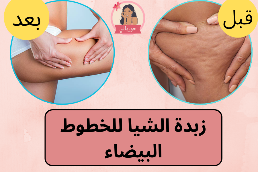 زبدة الشيا للخطوط البيضاء
