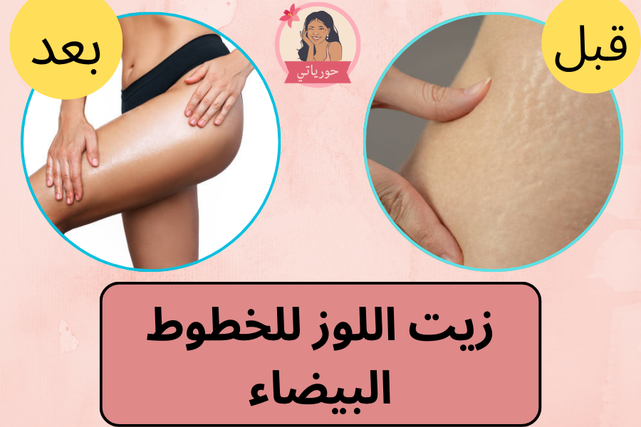 زيت اللوز للخطوط البيضاء