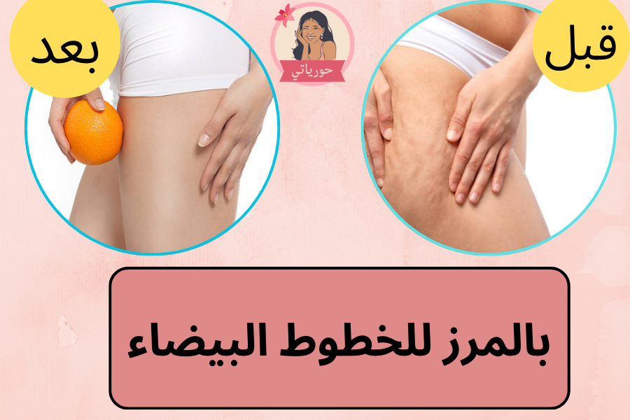 بالمرز للخطوط البيضاء
