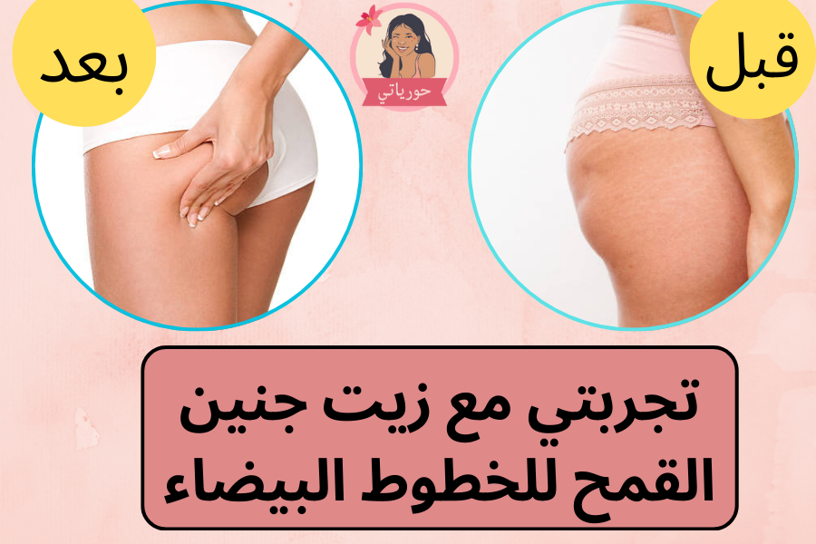 تجربتي مع زيت جنين القمح للخطوط البيضاء
