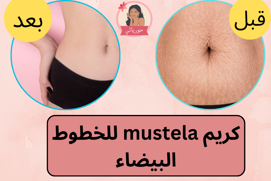 كريم mustela للخطوط البيضاء
