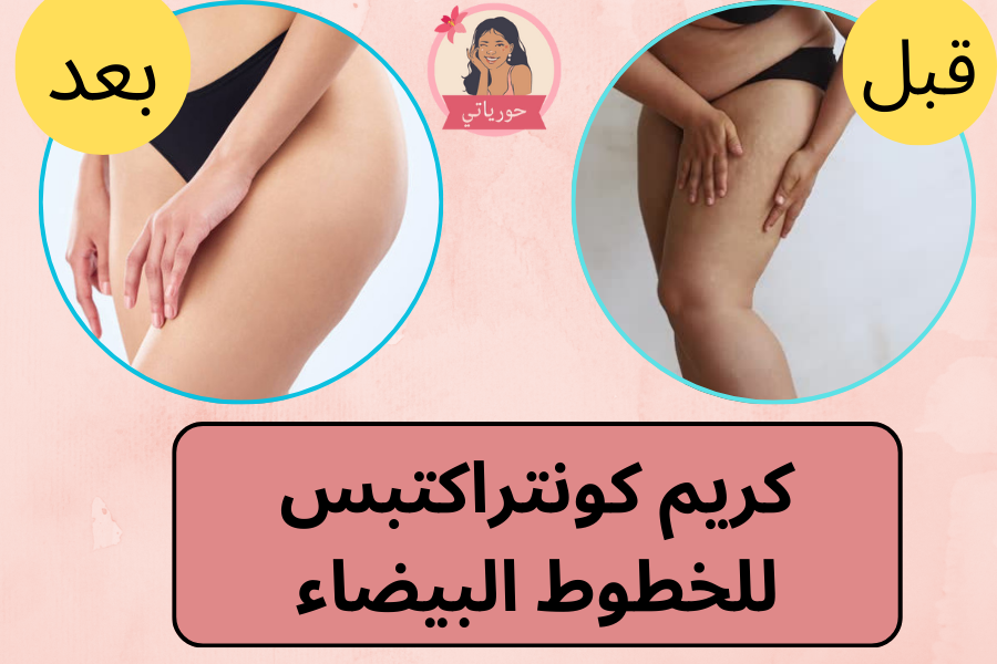 كريم كونتراكتبس للخطوط البيضاء