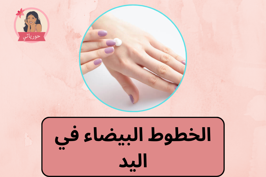 الخطوط البيضاء في اليد