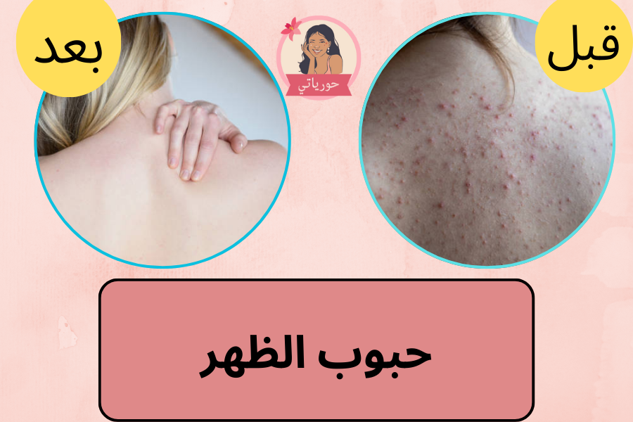 حبوب الظهر