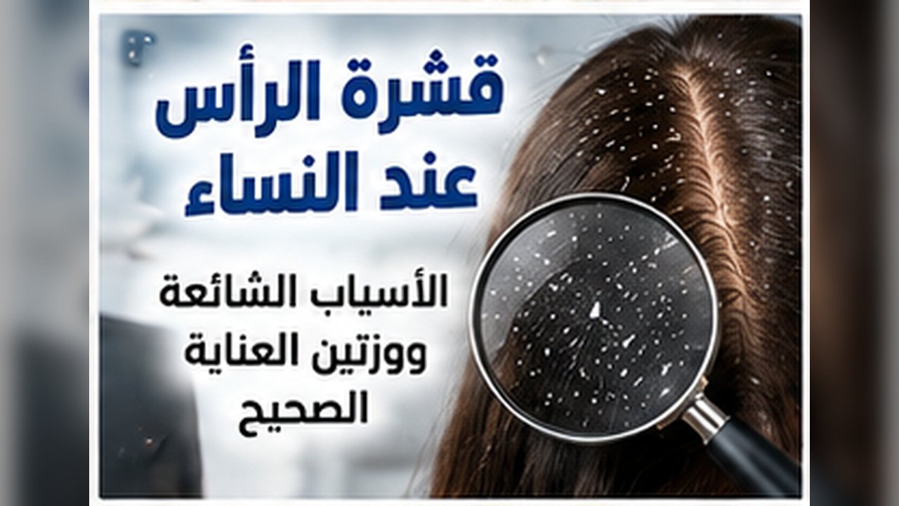 قشرة الرأس عند النساء: الأسباب الشائعة وروتين العناية الصحيح